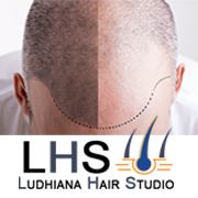 Ludhiana Hair Studio – Hair Transplantation FUE