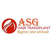 Hair Transplant in Punjab